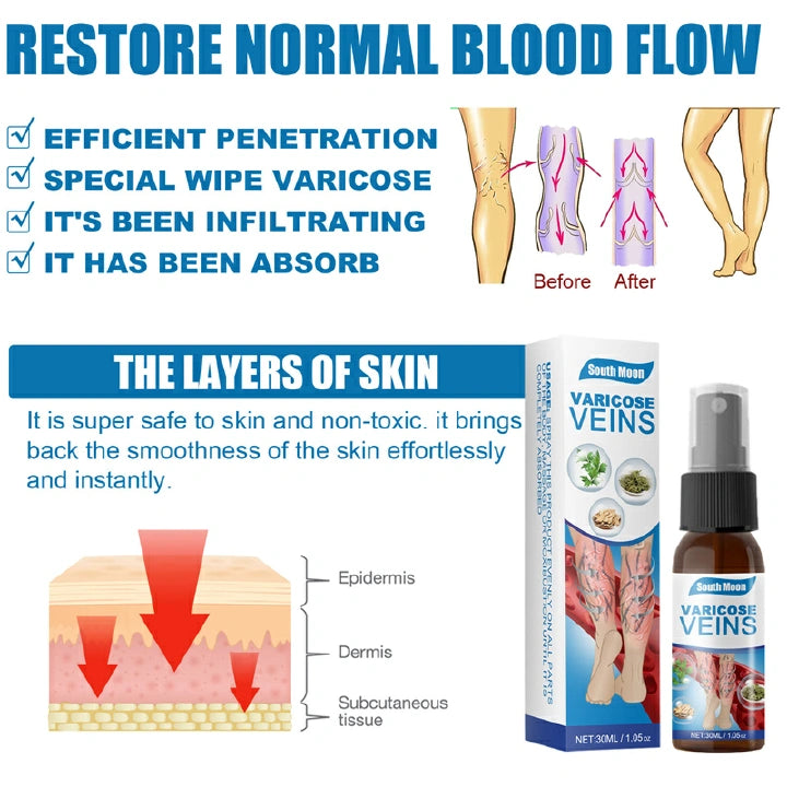 Varicose Veins Treatment Spray - ( BUY 1 GET 1 FREE )