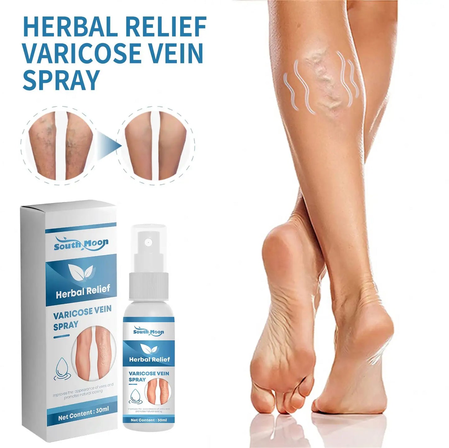 Varicose Veins Treatment Spray - ( BUY 1 GET 1 FREE )