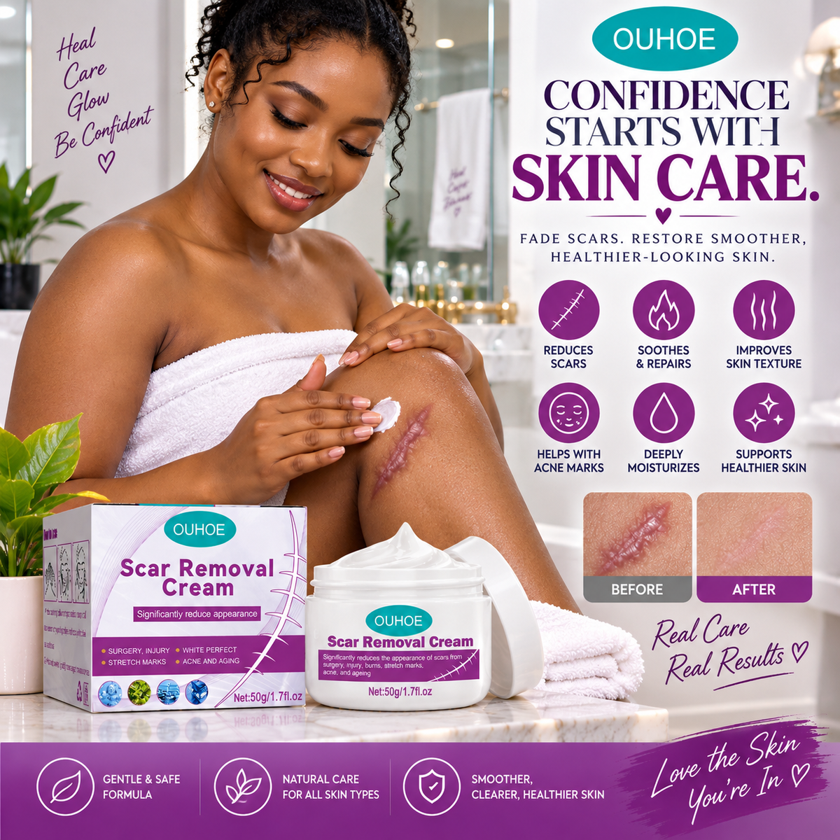 Scar & Stretch Marks Removal Cream