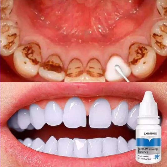 Teeth Whitening Essence – Natural Stain Remover for Yellow Teeth, Fresh Breath & Oral Care – Removes Coffee, Tea, Tobacco Stains – 10ml