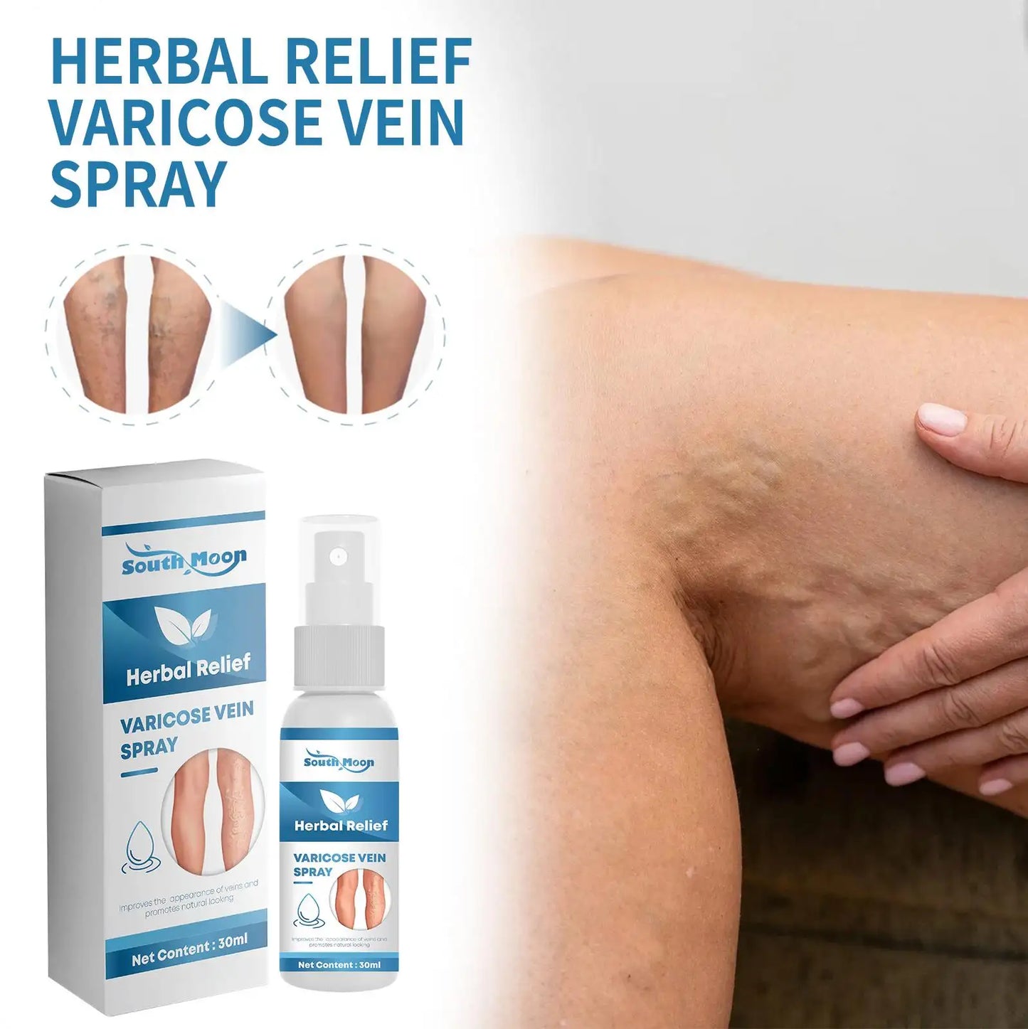 Varicose Veins Treatment Spray - ( BUY 1 GET 1 FREE )