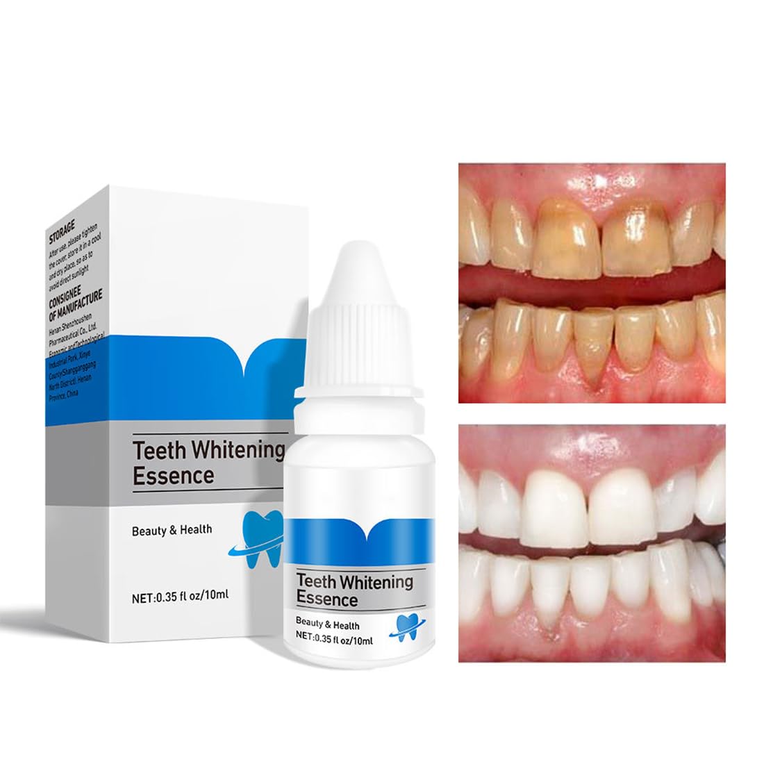 Teeth Whitening Essence – Natural Stain Remover for Yellow Teeth, Fresh Breath & Oral Care – Removes Coffee, Tea, Tobacco Stains – 10ml