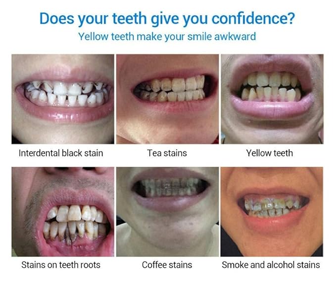 Teeth Whitening Essence – Natural Stain Remover for Yellow Teeth, Fresh Breath & Oral Care – Removes Coffee, Tea, Tobacco Stains – 10ml
