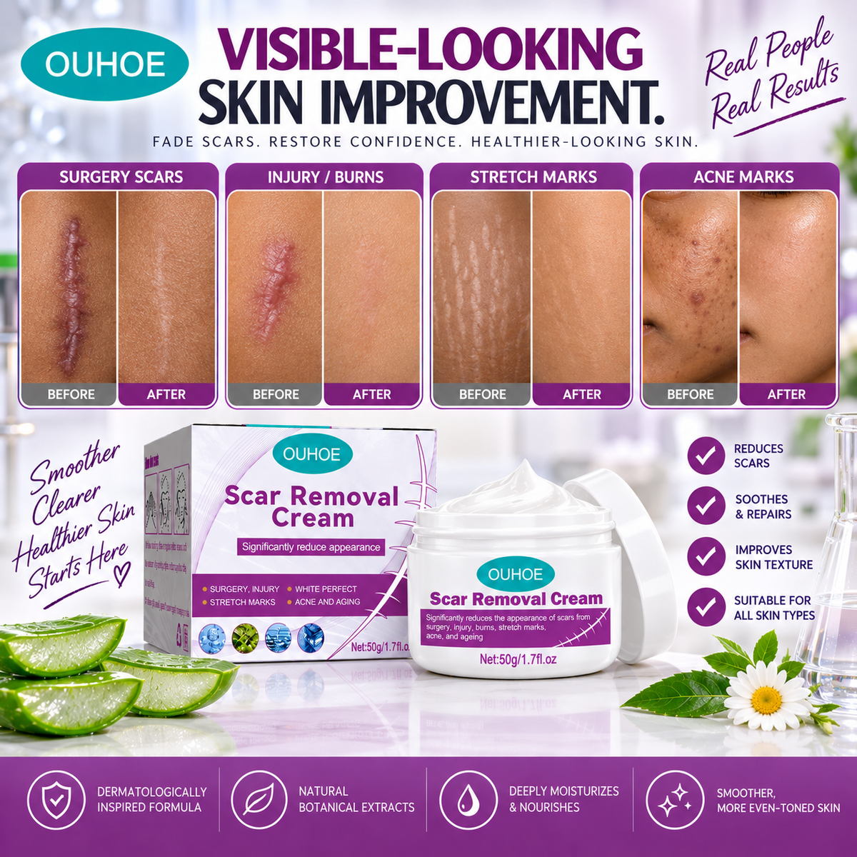 Scar & Stretch Marks Removal Cream