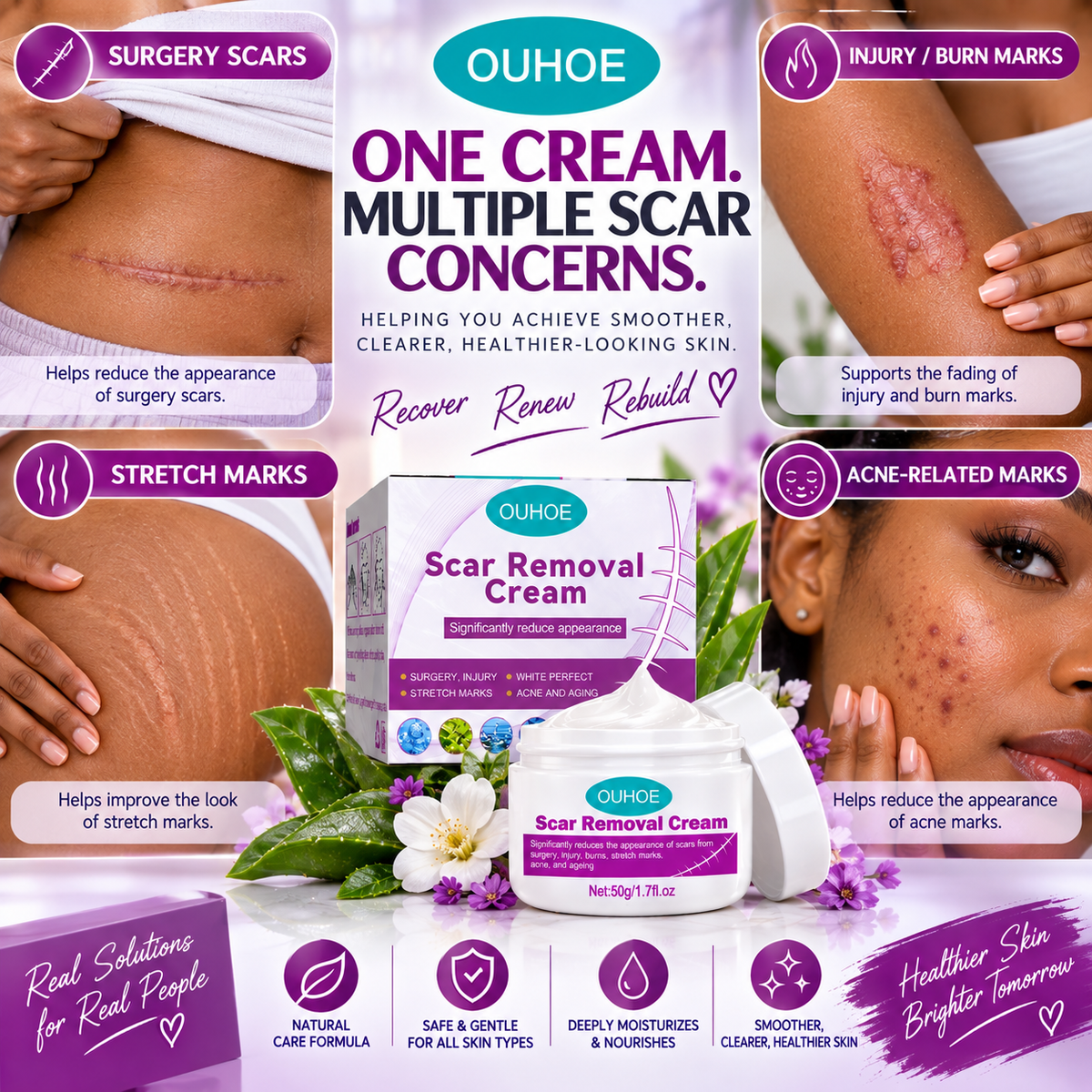 Scar & Stretch Marks Removal Cream