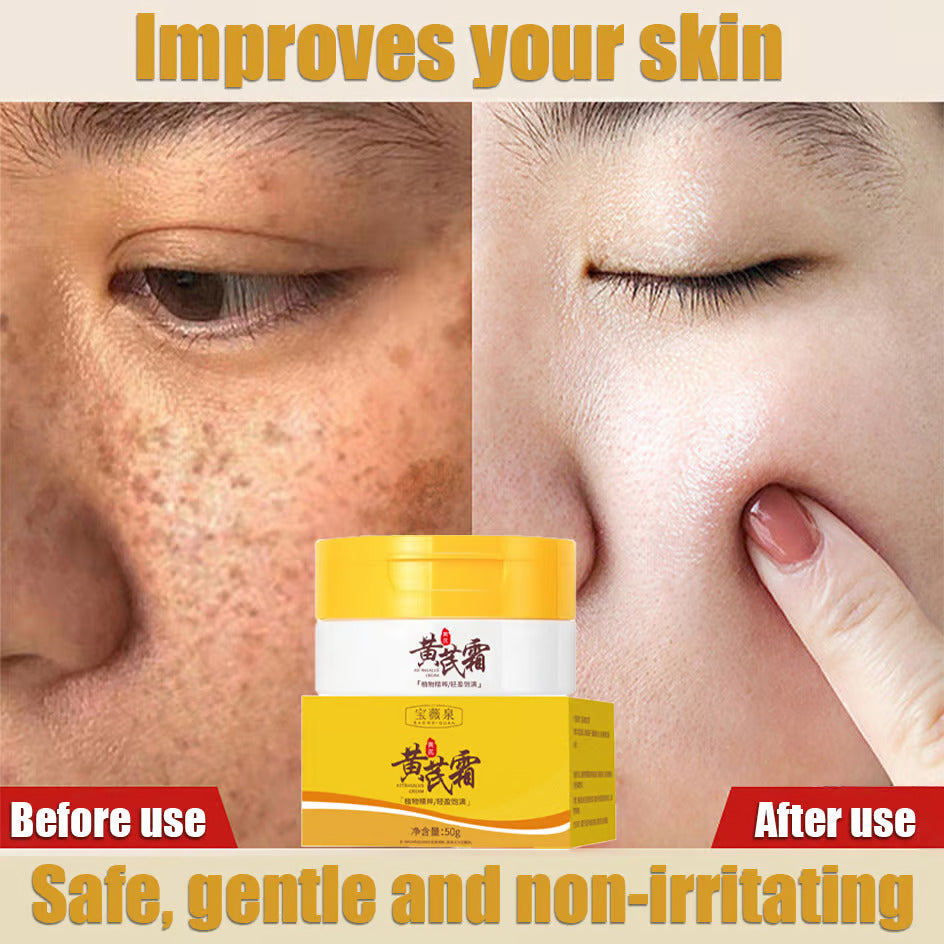 Dark Spots and Acne Removal Cream (BUY ONE GET ONE FREE)